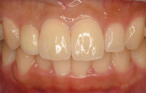 髪にシナモンを使ってみる方法